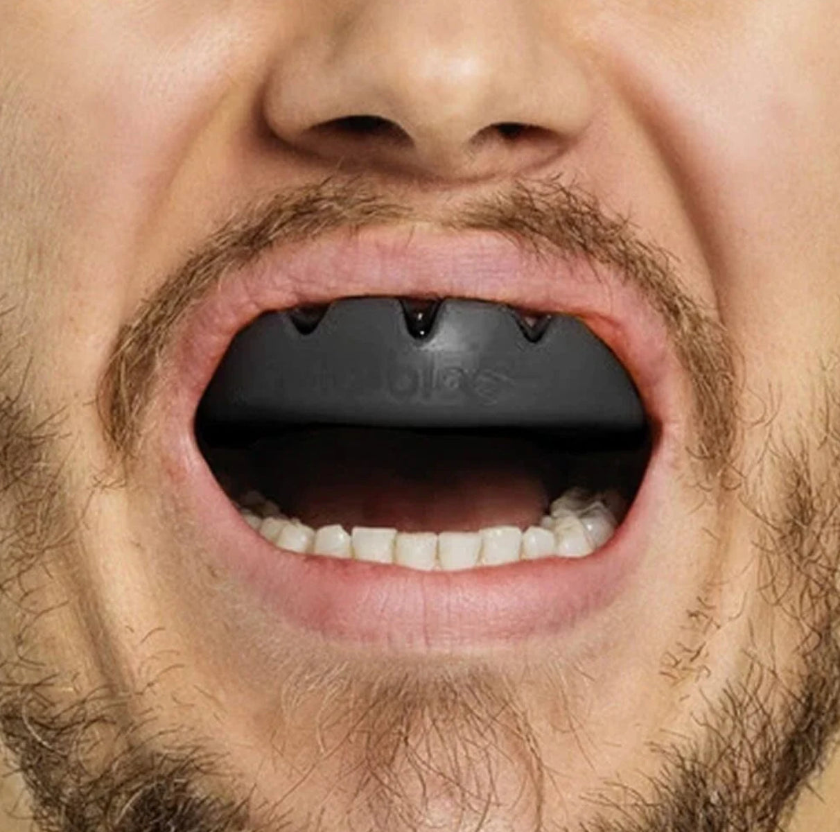 Lobloo SLICK Professional Dual Density Mouth Guard
